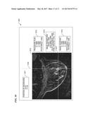 SYSTEM AND METHOD FOR MRI-GUIDED BREAST INTERVENTIONS diagram and image