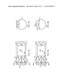 Method For Aortic Branched Vessel Repair diagram and image