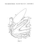 Method For Aortic Branched Vessel Repair diagram and image