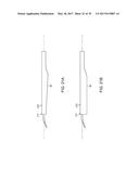 Method For Aortic Branched Vessel Repair diagram and image