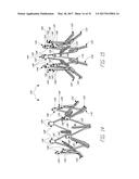 IMPLANTABLE DEVICE AND DELIVERY SYSTEM FOR RESHAPING A HEART VALVE ANNULUS diagram and image