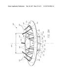 IMPLANTABLE DEVICE AND DELIVERY SYSTEM FOR RESHAPING A HEART VALVE ANNULUS diagram and image