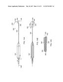 SYSTEMS AND DEVICES FOR SETTING AN ANCHOR diagram and image