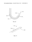 SYSTEMS AND DEVICES FOR SETTING AN ANCHOR diagram and image