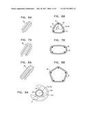 DEVICES AND METHODS FOR CONTROL OF BLOOD PRESSURE diagram and image