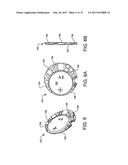 Implantable Electroacupuncture System and Method for Treating Dyslipidemia     and Obesity diagram and image