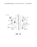 Implantable Electroacupuncture System and Method for Treating Dyslipidemia     and Obesity diagram and image