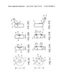 Implantable Electroacupuncture System and Method for Treating Dyslipidemia     and Obesity diagram and image