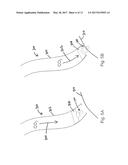 METHODS FOR LOCALIZED DRUG DELIVERY diagram and image