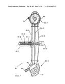 METHODS OF USING REGENERATIVE CELLS IN THE TREATMENT OF MUSCULOSKELETAL     DISORDERS diagram and image