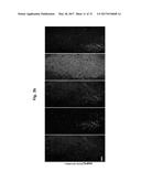 COMPOSITION FOR TREATING ISCHEMIC DISEASES OR NEUROINFLAMMATORY DISEASES     CONTAINING NEURAL PROGENITOR CELLS OR SECRETOME THEREOF AS ACTIVE     INGREDIENT diagram and image