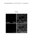 COMPOSITION FOR TREATING ISCHEMIC DISEASES OR NEUROINFLAMMATORY DISEASES     CONTAINING NEURAL PROGENITOR CELLS OR SECRETOME THEREOF AS ACTIVE     INGREDIENT diagram and image