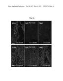 COMPOSITION FOR TREATING ISCHEMIC DISEASES OR NEUROINFLAMMATORY DISEASES     CONTAINING NEURAL PROGENITOR CELLS OR SECRETOME THEREOF AS ACTIVE     INGREDIENT diagram and image