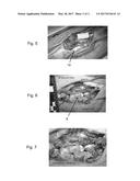 METHOD OF SEALING A DUROTOMY diagram and image