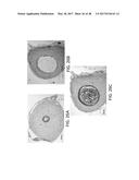 METHODS FOR VAS-OCCLUSIVE CONTRACEPTION AND REVERSAL THEREOF diagram and image