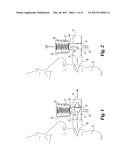 POSITIVE EXPIRATORY PRESSURE DEVICES WITH FLUTTER VALVE diagram and image