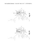 POSITIVE EXPIRATORY PRESSURE DEVICES WITH FLUTTER VALVE diagram and image