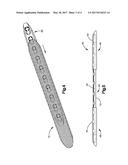 DRUG-IMPREGNATED ENCASEMENT diagram and image