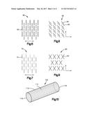 DRUG-IMPREGNATED ENCASEMENT diagram and image