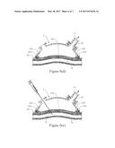 VASCULAR ACCESS DEVICE AND METHOD OF USE THEREOF diagram and image