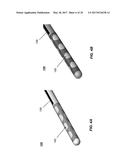 TREATMENT OF AUTOIMMUNE DISEASES WITH DEEP BRAIN STIMULATION diagram and image