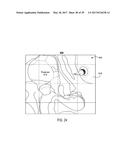 TREATMENT OF AUTOIMMUNE DISEASES WITH DEEP BRAIN STIMULATION diagram and image