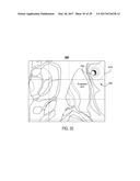 TREATMENT OF AUTOIMMUNE DISEASES WITH DEEP BRAIN STIMULATION diagram and image