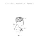 METHOD AND APPARATUS FOR PREVENTING OR TERMINATING EPILEPTIC SEIZURES diagram and image