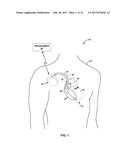 PRIORITIZED PROGRAMMING OF MULTI-ELECTRODE PACING LEADS diagram and image