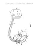 PRIORITIZED PROGRAMMING OF MULTI-ELECTRODE PACING LEADS diagram and image