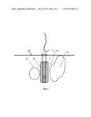 TISSUE STABILIZATION FOR THERAPEUTIC ULTRASOUND diagram and image