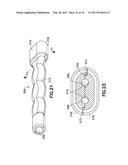 FLUID PATH SET WITH TURBULENT MIXING CHAMBER, BACK FLOW COMPENSATOR diagram and image