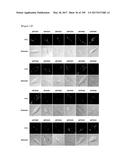 CELL-PERMEABLE (ICP)-SOCS3 RECOMBINANT PROTEIN AND USES THEREOF diagram and image