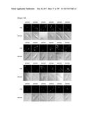 CELL-PERMEABLE (ICP)-SOCS3 RECOMBINANT PROTEIN AND USES THEREOF diagram and image