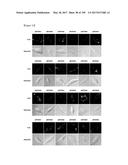 CELL-PERMEABLE (ICP)-SOCS3 RECOMBINANT PROTEIN AND USES THEREOF diagram and image