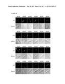 CELL-PERMEABLE (ICP)-SOCS3 RECOMBINANT PROTEIN AND USES THEREOF diagram and image