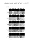 CELL-PERMEABLE (ICP)-SOCS3 RECOMBINANT PROTEIN AND USES THEREOF diagram and image