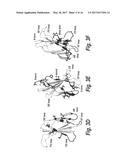 FIBRONECTIN BINDING DOMAINS WITH REDUCED IMMUNOGENICITY diagram and image