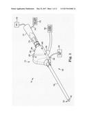 DEBRIDEMENT DEVICE AND METHOD diagram and image