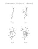 DEVICES AND METHODS FOR ENHANCED DENERVATION PROCEDURES diagram and image