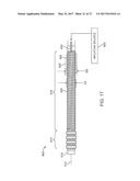 SYSTEMS AND METHODS FOR ENDOMETRIAL ABLATION diagram and image