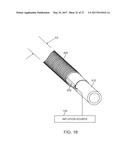 SYSTEMS AND METHODS FOR ENDOMETRIAL ABLATION diagram and image