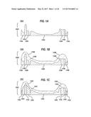 LENS PRECURSOR WITH FEATURES FOR THE FABRICATION OF AN OPHTHALMIC LENS diagram and image