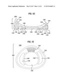 LENS PRECURSOR WITH FEATURES FOR THE FABRICATION OF AN OPHTHALMIC LENS diagram and image