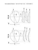 LENS PRECURSOR WITH FEATURES FOR THE FABRICATION OF AN OPHTHALMIC LENS diagram and image