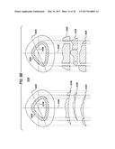 LENS PRECURSOR WITH FEATURES FOR THE FABRICATION OF AN OPHTHALMIC LENS diagram and image