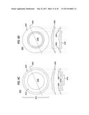 LENS PRECURSOR WITH FEATURES FOR THE FABRICATION OF AN OPHTHALMIC LENS diagram and image