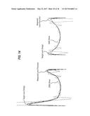 LENS PRECURSOR WITH FEATURES FOR THE FABRICATION OF AN OPHTHALMIC LENS diagram and image