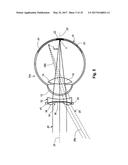 MYOPIA CONTROL MEANS diagram and image