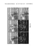 Optoacoustic Probe With Multi-Layer Coating diagram and image